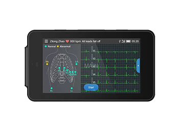 Comparison of Portable Ecg Machines and Holter Monitoring Systems