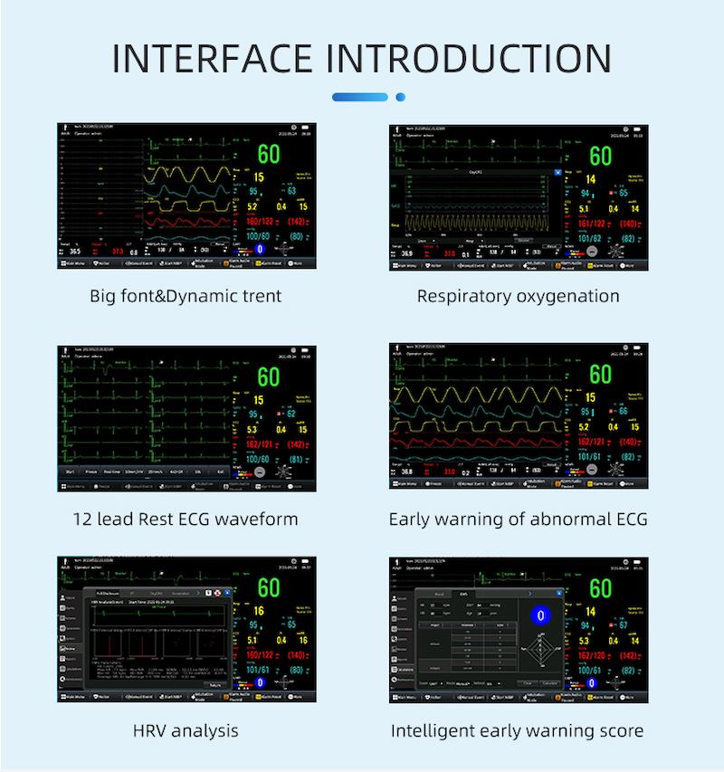 How to Read A Vital Signs Monitor 