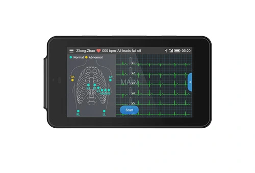 180b Handheld Ecg Ekg Portable Monitor Electrocardiogramme Lcd pour une  utilisation de voyage à domicile