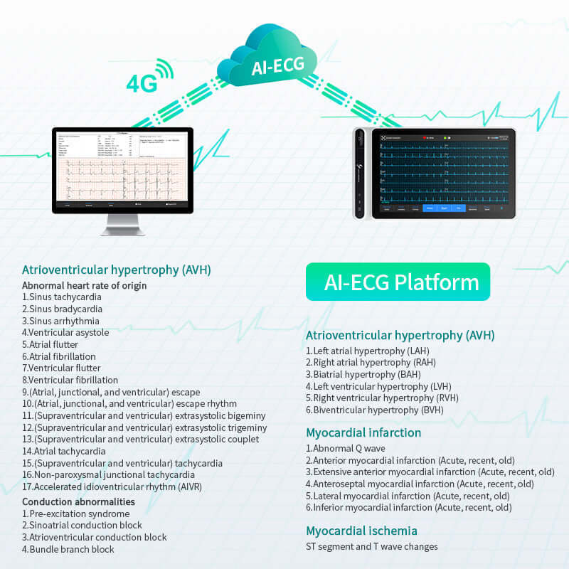 LepuMedicalAIAnalysisDiagnostic12-leadECGMonitorTabletNeoECGS120HeartRateDetectionwith7-inchTouchScr_(1).jpg